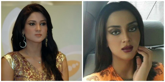 Plastic Surgery Photos of 13 Pakistani Celebrities