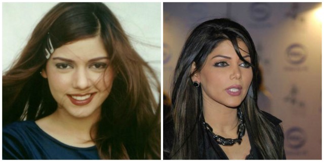 Plastic Surgery Photos of 13 Pakistani Celebrities