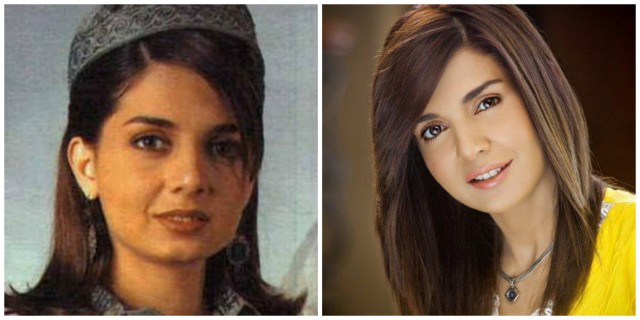 Plastic Surgery Photos of 13 Pakistani Celebrities