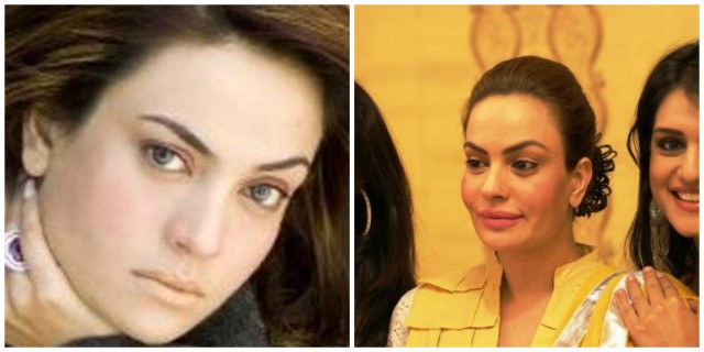 Plastic Surgery Photos of 13 Pakistani Celebrities