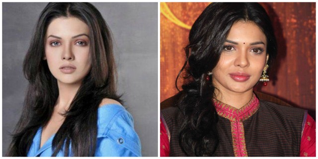 Plastic Surgery Photos of 13 Pakistani Celebrities